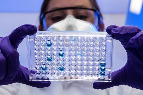 Les mystères des agents infectieux: plonger dans l'univers fascinant de la virologie